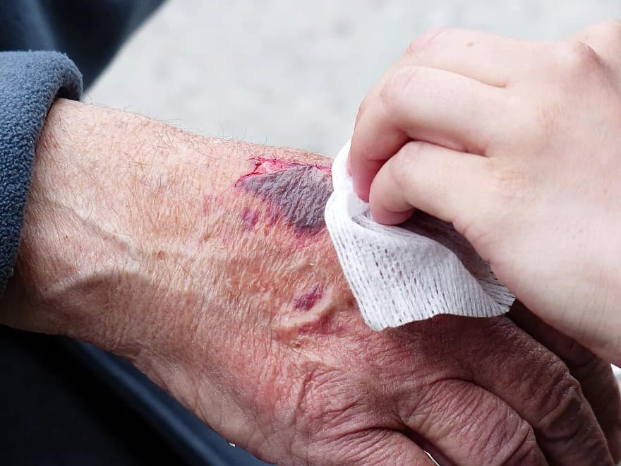 Wound Care Management